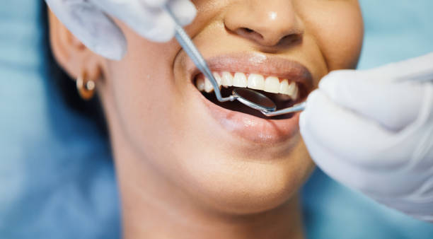Best Broken or Cracked Tooth Emergency Dentist in Tidmore Bend, AL